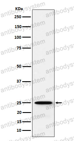 Anti-GSTK1 Antibody (R2L05)