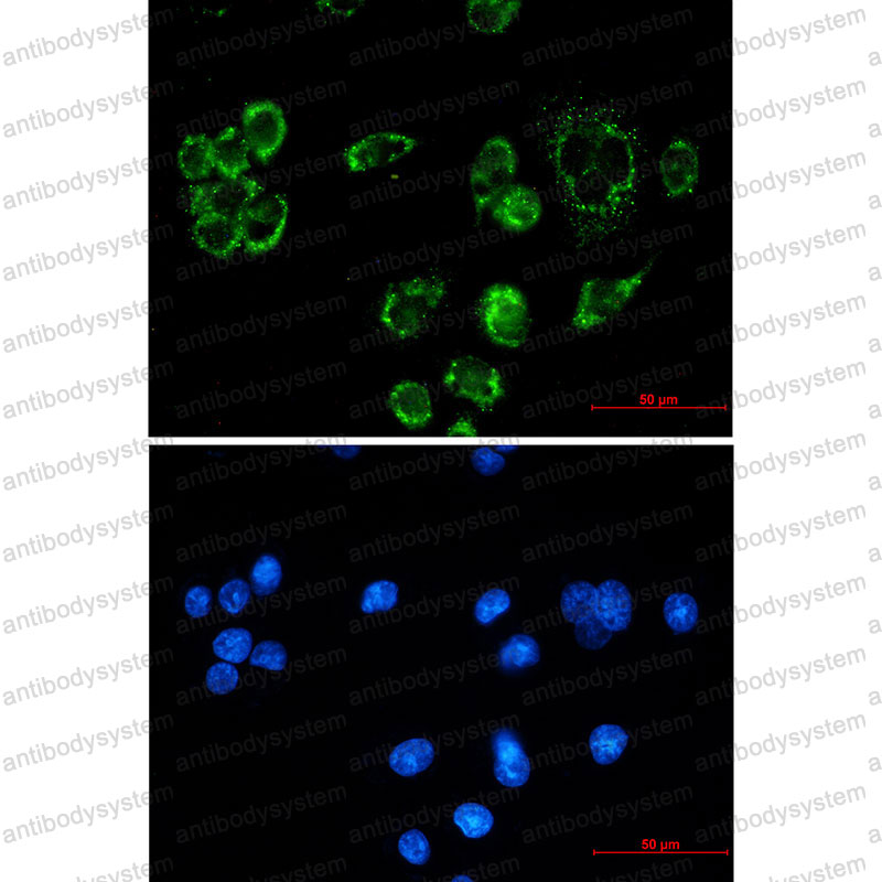Anti-FIS1 Antibody (R2L10)