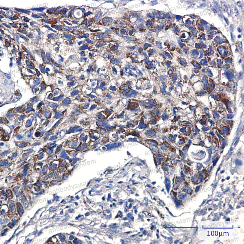Immunohistochemical for Anti-FIS1 Antibody (R2L10) ?>