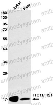 Western blot for Anti-FIS1 Antibody (R2L10) ?>