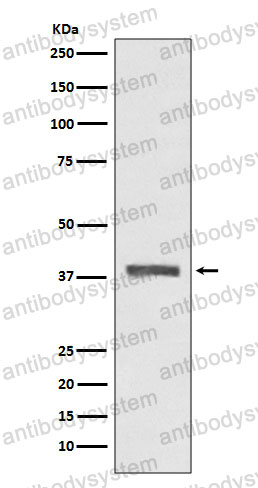 Anti-PRKAB1 Antibody (R2L11)