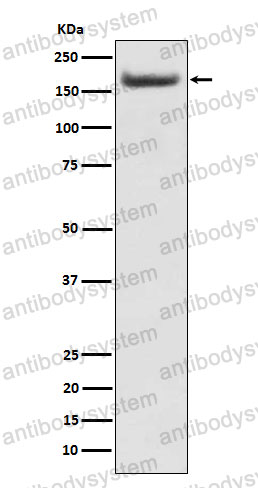 Anti-IRS2 Antibody (R2L12)