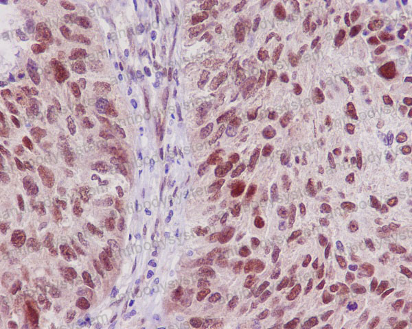 Anti-TRAF6 Antibody (R1A79)