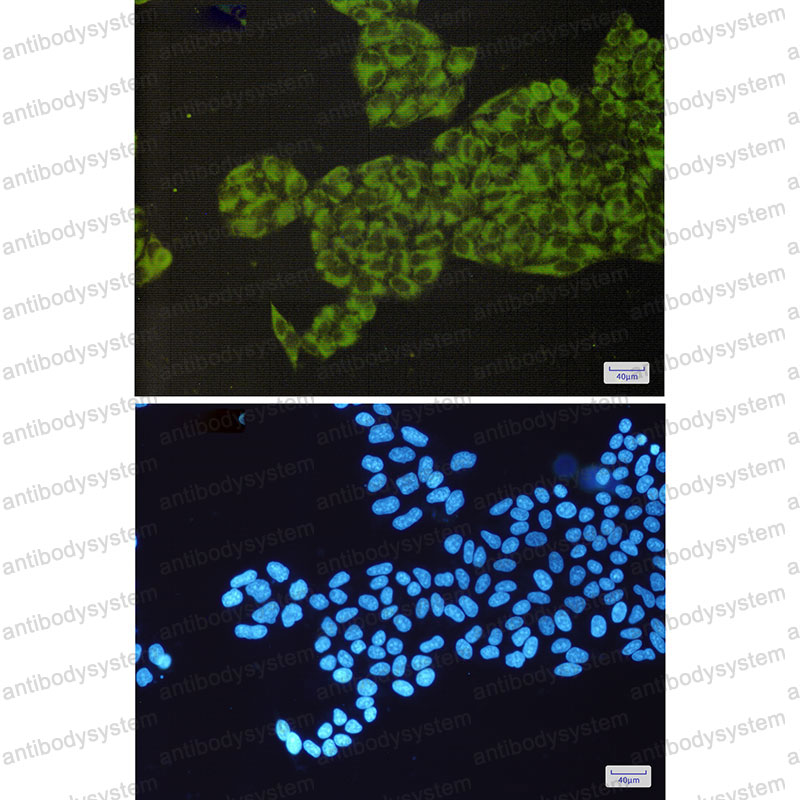 Anti-HYOU1 Antibody (R2L17)