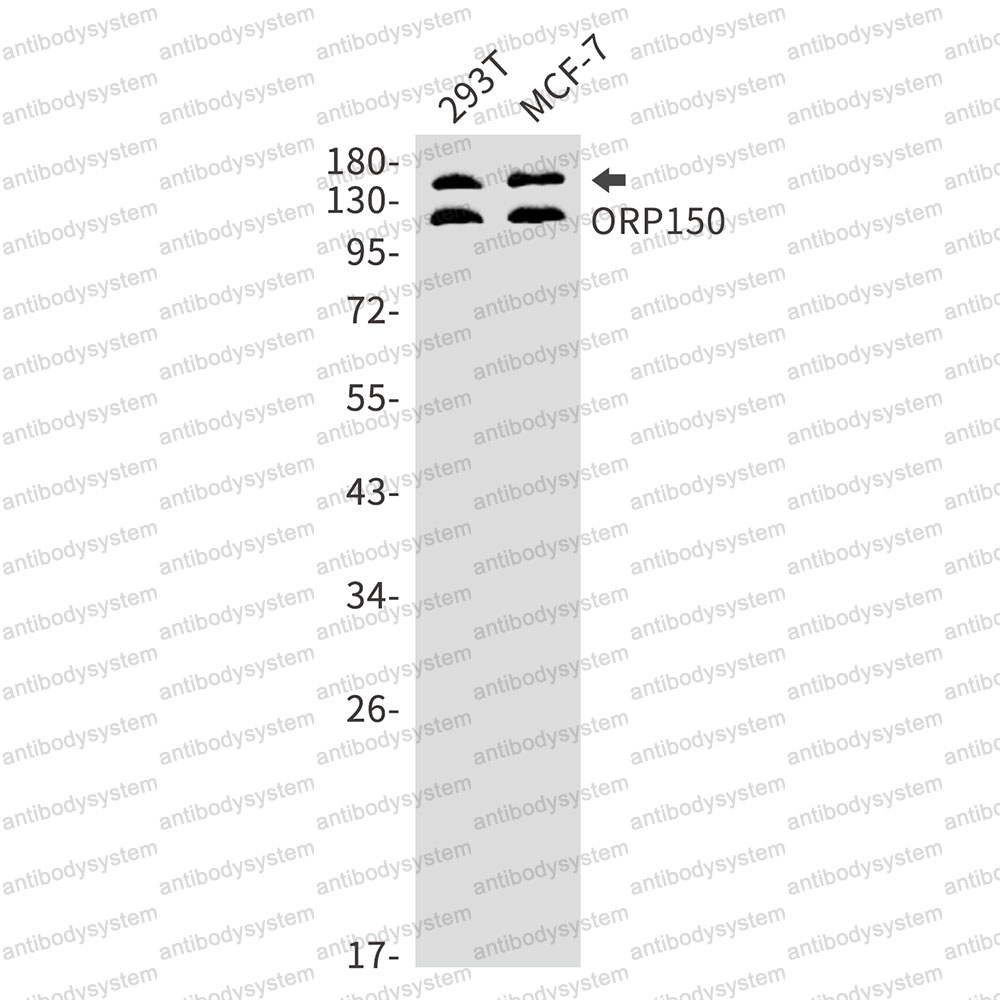 Anti-HYOU1 Antibody (R2L16)