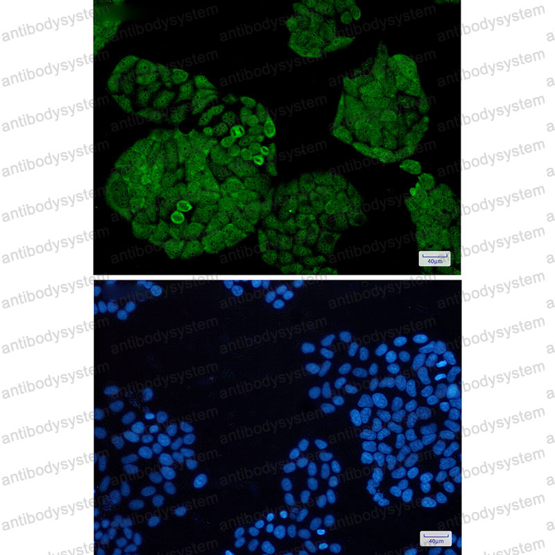 Anti-UCHL5 Antibody (R2L21)
