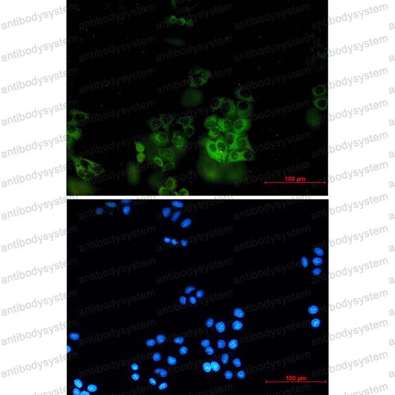 Anti-SNX9 Antibody (R2L22)
