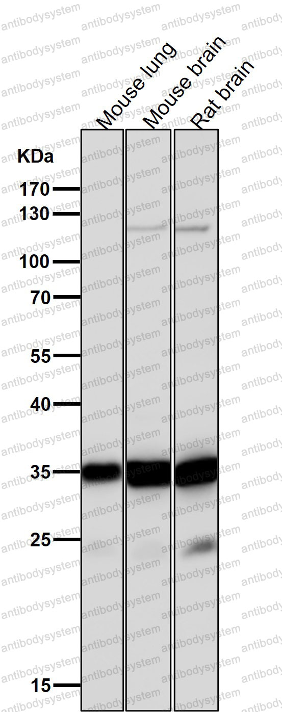 Anti-LYVE1 Antibody (R2L23)
