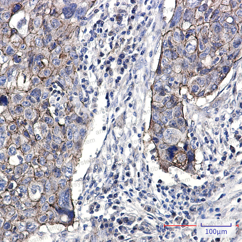 Anti-CD321/F11R/JAM-A Antibody (R2L25)