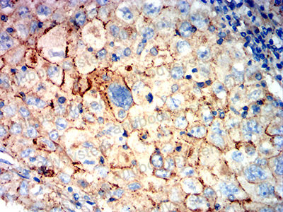 Immunohistochemical for Anti-CD321/F11R/JAM-A Antibody (R3X78) ?>