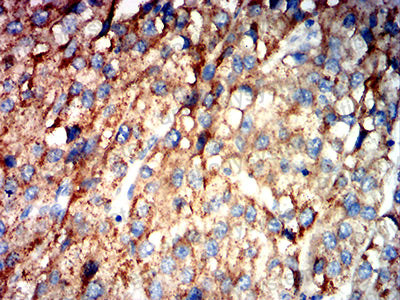 Immunohistochemical for Anti-CD321/F11R/JAM-A Antibody (R3X78) ?>