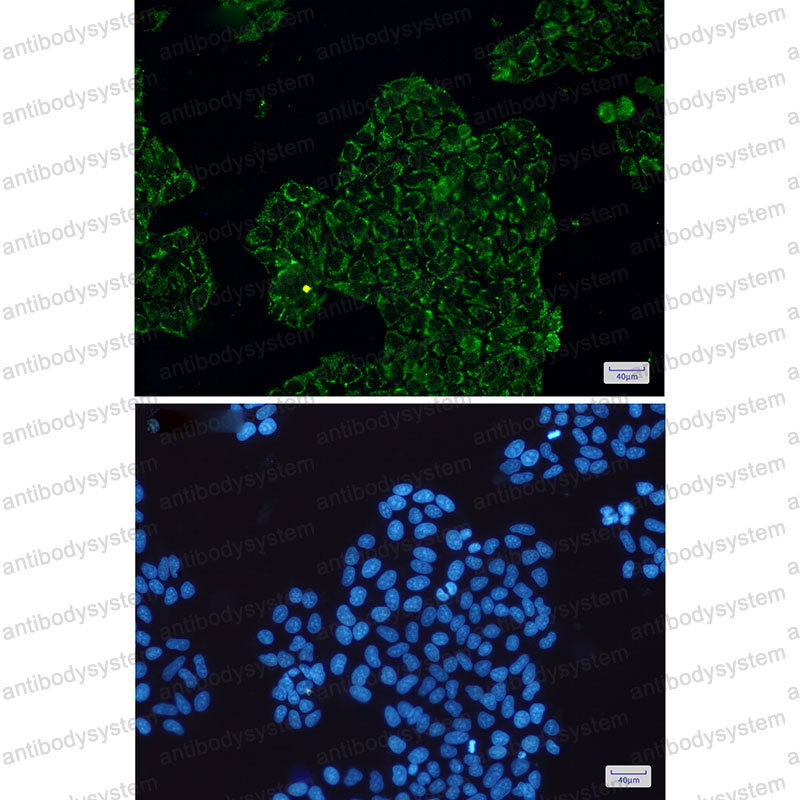 Anti-CLIC4 Antibody (R2L28)