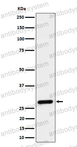 Anti-CLIC4 Antibody (R2L27)