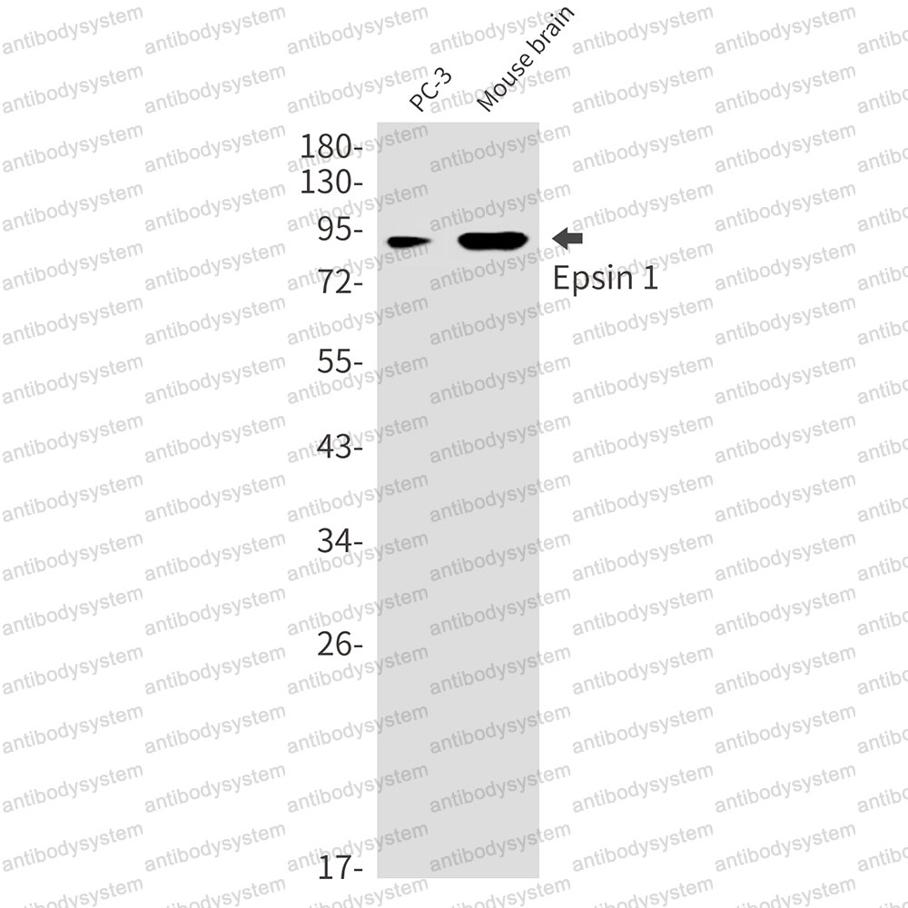 Anti-EPN1 Antibody (R2L29)