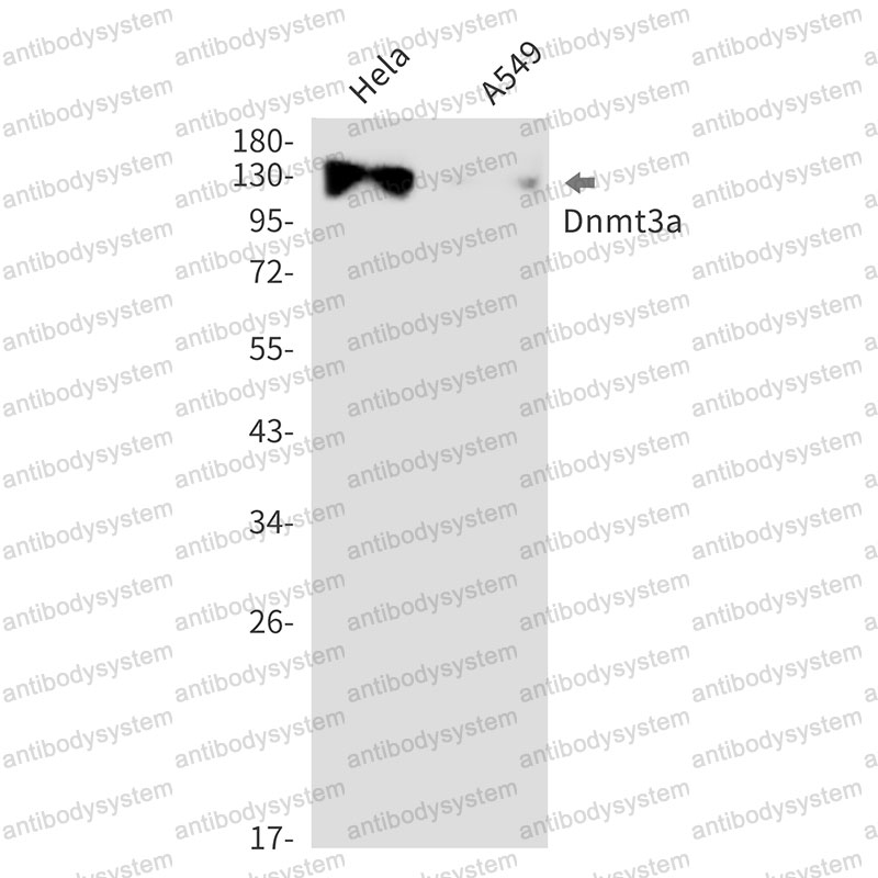 Anti-DNMT3A Antibody (R2L30)