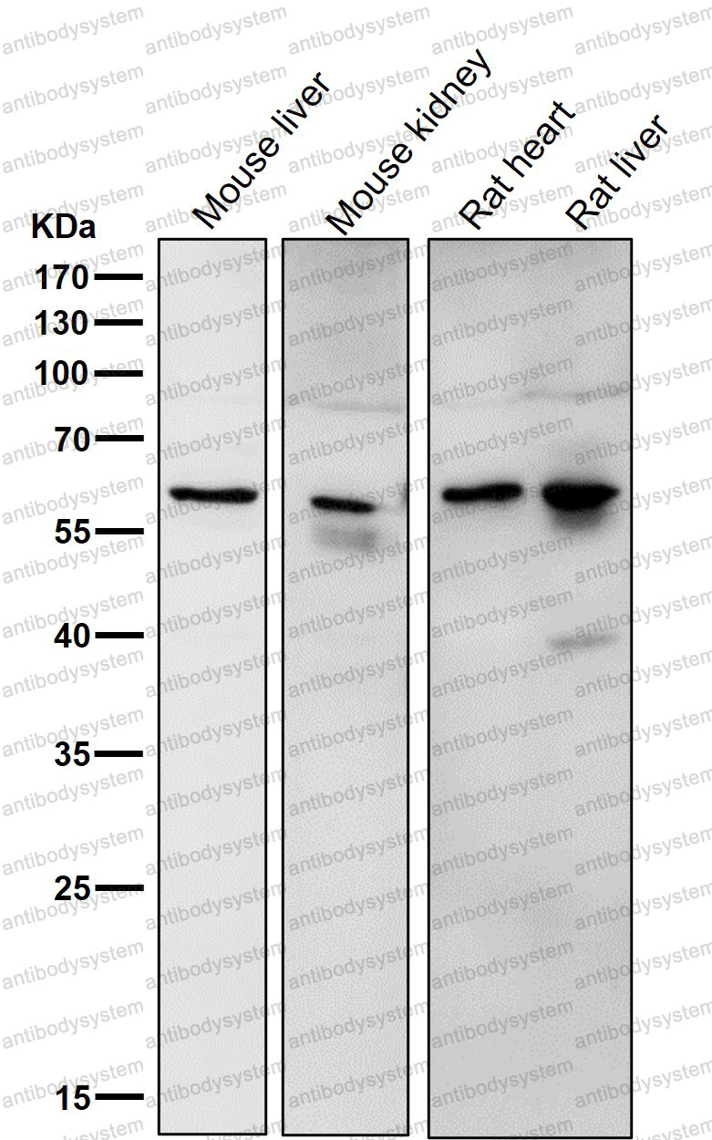 Anti-IGF2BP2 Antibody (R2L31)