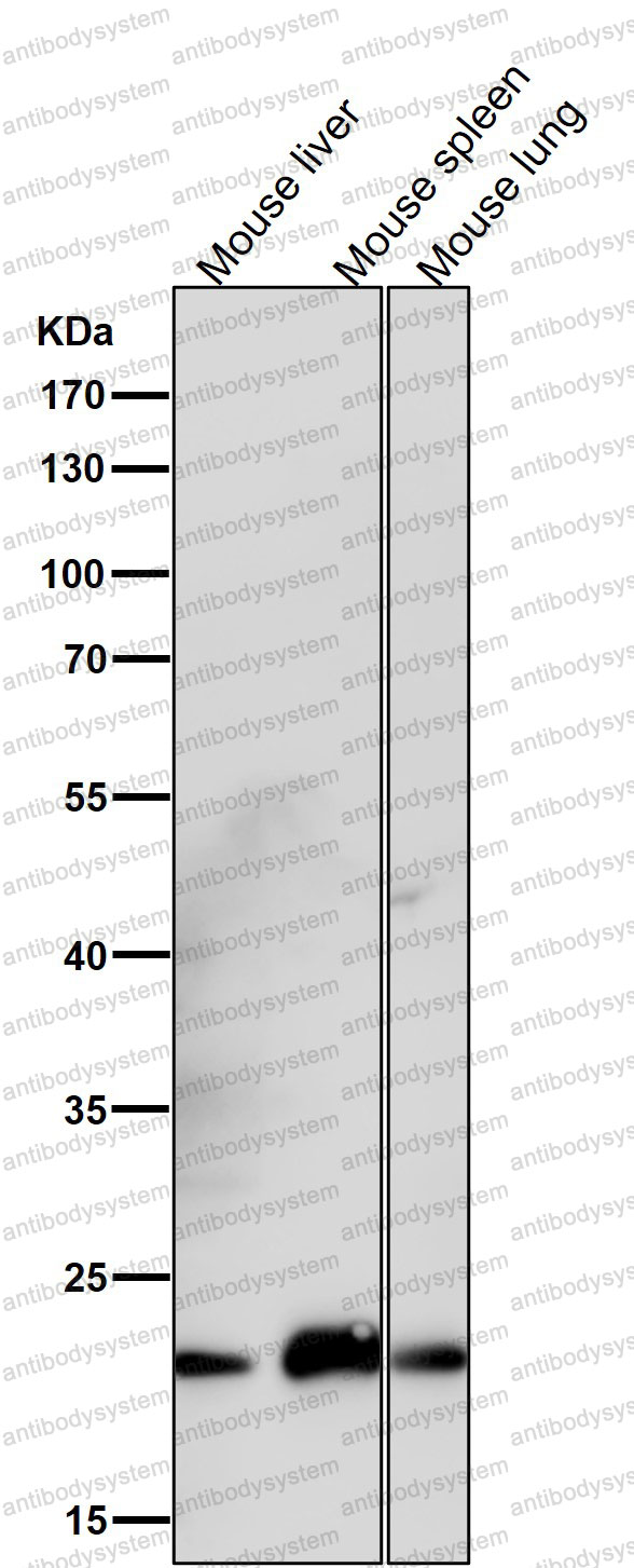 Anti-CD278/ICOS Antibody (R2L33)