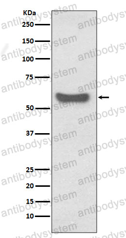 Anti-Human IgA Antibody (R2L34)