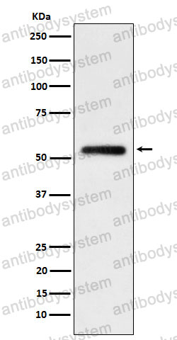 Anti-Human IgG1 Antibody (R2L36)