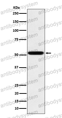 Anti-Human IgG2 Antibody (R2L37)