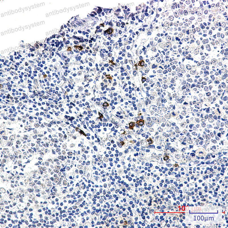 Anti-Human IgG4 Antibody (R2L39)