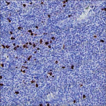 Anti-Human IgG4 Antibody (R3X98)