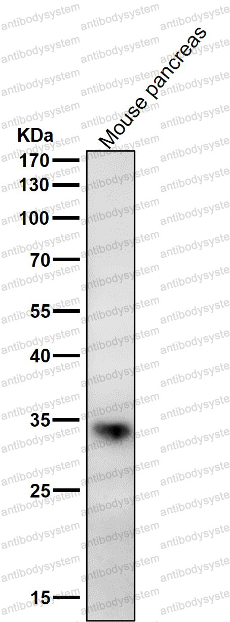 Anti-ERP27 Antibody (R2L40)