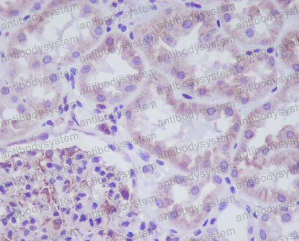 Anti-ADIPOR1 Antibody (R2L41)