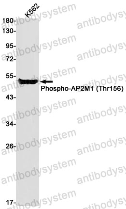 Anti-Phospho-AP2M1 (Thr156) Antibody (R2L42)