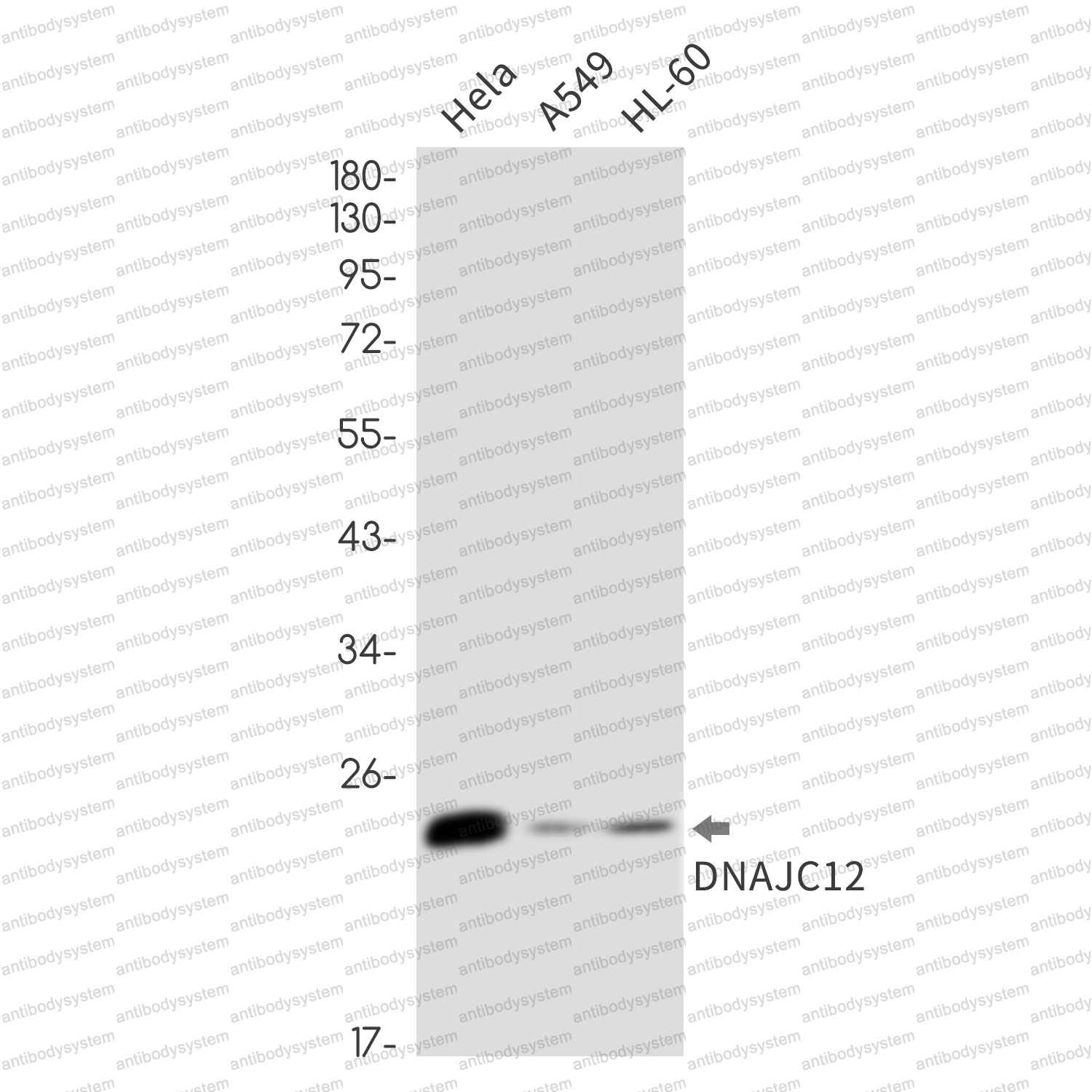 Anti-DNAJC12 Antibody (R2L44)