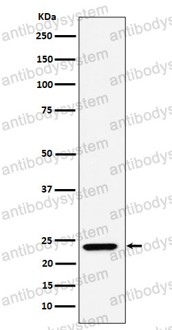 Anti-DNAJC12 Antibody (R2L43)