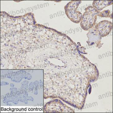 Immunohistochemical for Anti-C1QTNF1 Antibody (R3Y23) ?>