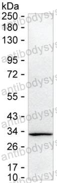 Western blot for Anti-C1QTNF1 Antibody (R3Y24) ?>