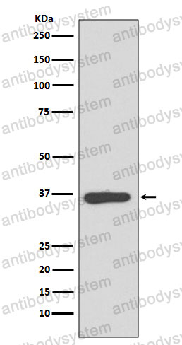 Anti-ANXA10 Antibody (R2L45)