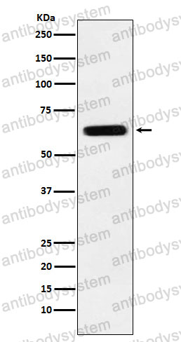 Anti-DPYSL5 Antibody (R2L46)