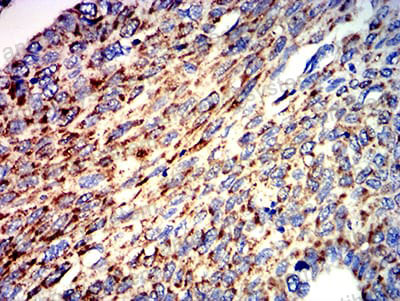Immunohistochemical for Anti-ATPIF1 Antibody (R3Y32) ?>