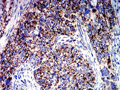 Immunohistochemical for Anti-ATPIF1 Antibody (R3Y32) ?>