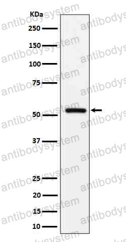 Anti-FETUB Antibody (R1B83)