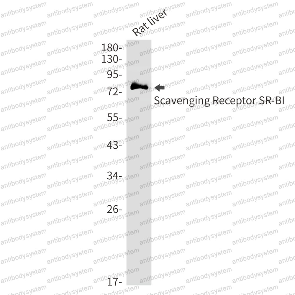 Anti-SCARB1/SR-BI/CLA-1/SRB1 Antibody (R2L60)