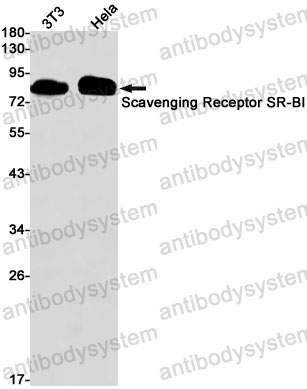Anti-SCARB1/SR-BI/CLA-1/SRB1 Antibody (R2L59)