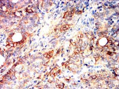 Immunohistochemical for Anti-SCARB1/SR-BI/CLA-1/SRB1 Antibody (R3Y42) ?>