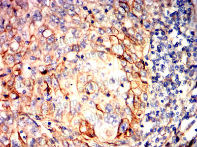 Immunohistochemical for Anti-SCARB1/SR-BI/CLA-1/SRB1 Antibody (R3Y42) ?>