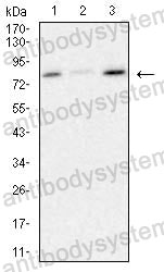 Western blot for Anti-SCARB1/SR-BI/CLA-1/SRB1 Antibody (R3Y42) ?>