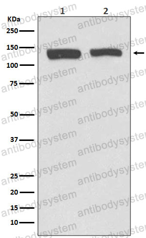 Anti-NEDD4L/Nedd4-2 Antibody (R2L61)
