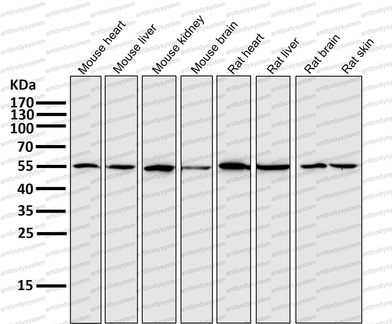 Anti-SLC7A11/xCT Antibody (R2L62)