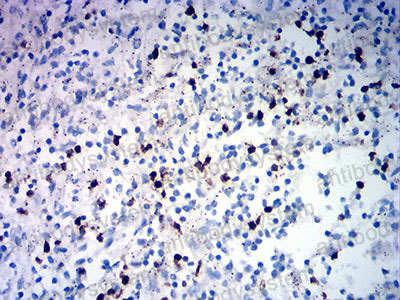 Immunohistochemical for Anti-TRBC1 Antibody (R3Y49) ?>