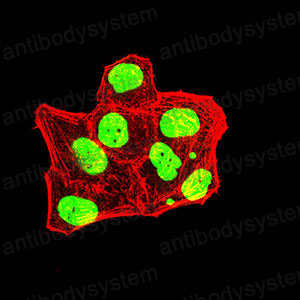 Immunofluorescence for Anti-TRBC1 Antibody (R3Y50) ?>