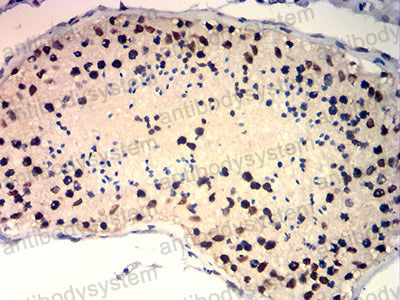 Immunohistochemical for Anti-TRBC1 Antibody (R3Y50) ?>