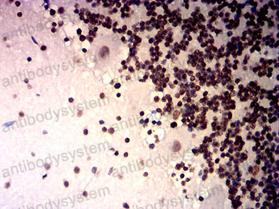 Immunohistochemical for Anti-TRBC1 Antibody (R3Y50) ?>