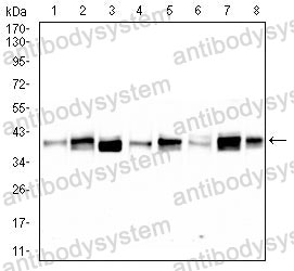Western blot for Anti-TRBC1 Antibody (R3Y50) ?>